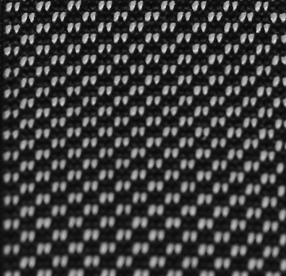 Black with White Dots Braces